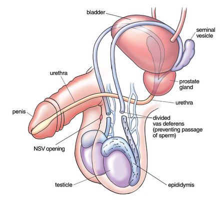 how-does-vasectomy-work